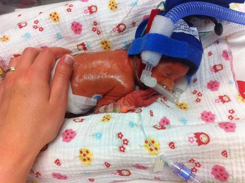 The Harcourts Foundation Partners with Miracle Babies